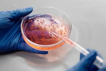Utjecaj meda na rast bifidobakterija
